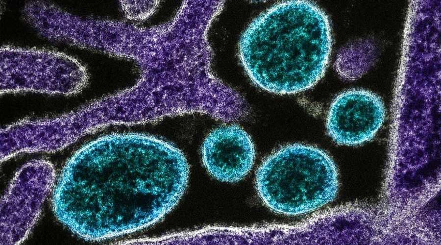 A New Drug that can Stop Nipah