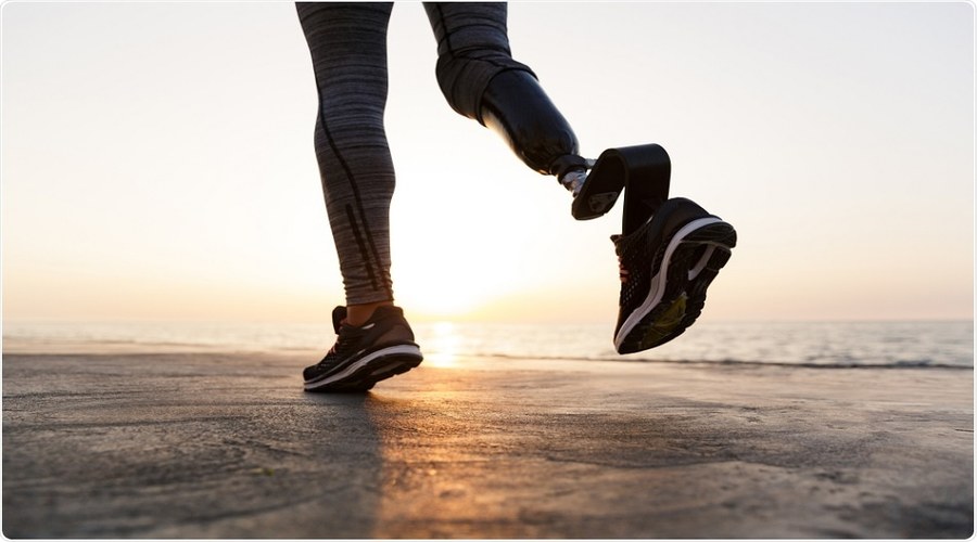 The Ultimate Prosthetic Limb- The Healthcare Insights